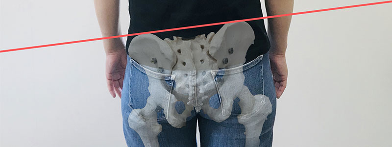 骨盤矯正